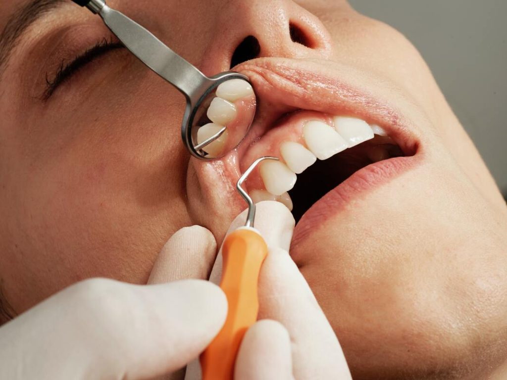 dentist on operation